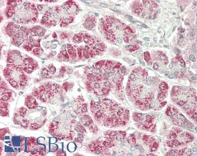 IHC-plus™ Polyclonal Rabbit anti-Human ASNS Antibody (IHC, IF, WB)