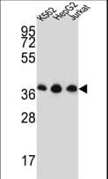 HNRNPDL / hnRNP D Antibody (aa206-234)