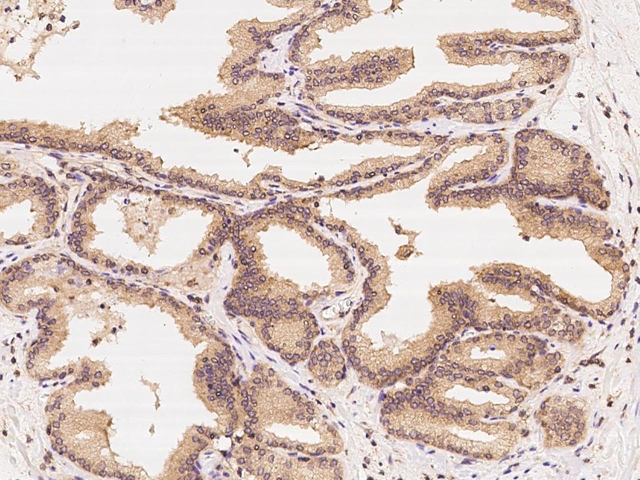 Polyclonal Rabbit anti-Human CCT3 Antibody (IHC, WB)
