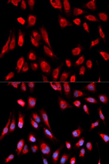 HSD17B10 / HADH2 Antibody