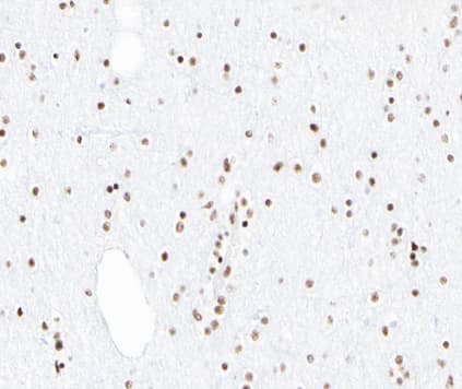 PIAS1 Antibody