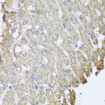 Polyclonal Rabbit anti-Human SET / TAF-I Antibody (IHC, WB)