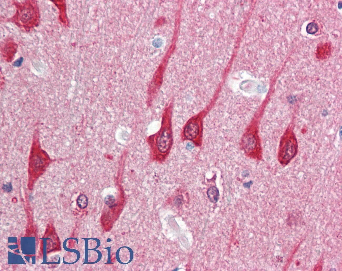 IHC-plus™ MAP1LC3B / LC3B Antibody (N-Terminus)