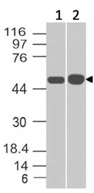 SERPINA1 / Alpha 1 Antitrypsin Antibody