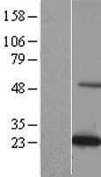 KXD1 / C19orf50 Protein (Over-Expression Lysate Myc-DDK (Flag))