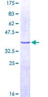 Human ADGRG1 / GPR56 Protein (Recombinant GST, N-terminus)