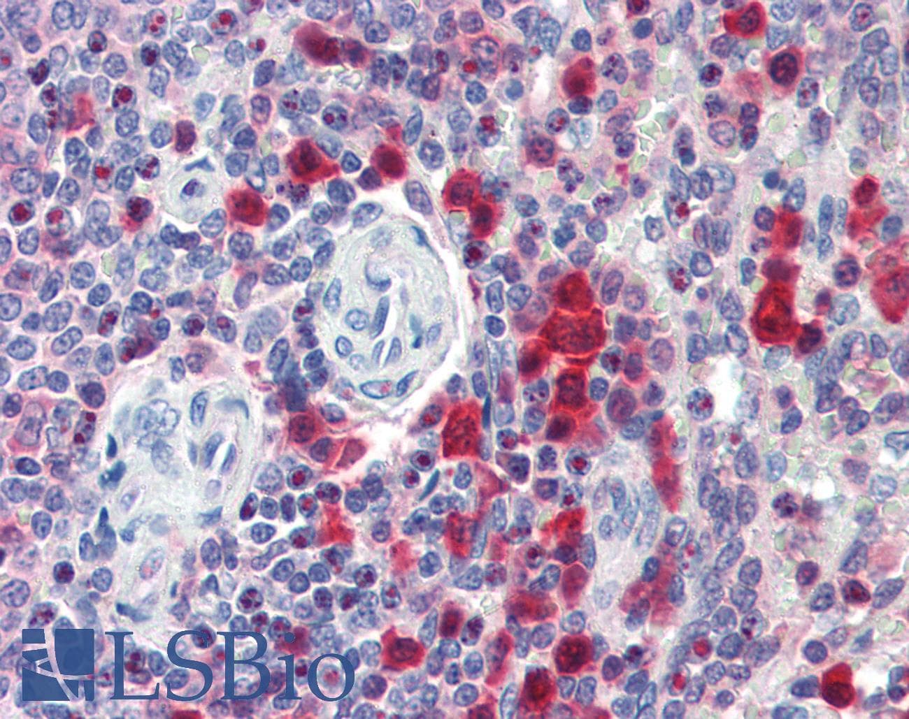 PathPlus™ CASP3 / Caspase 3 Antibody