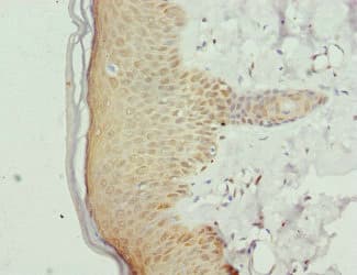 GABPB1 Antibody