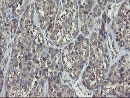 RIPK1 / RIP Antibody (aa133-422, clone OTI2D6, Carrier-free)