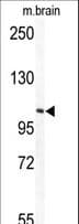 Polyclonal Rabbit anti-Human TECPR1 Antibody (aa1094-1122, IHC, WB)