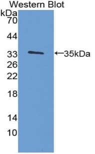 GDF15 Antibody (aa30-308)