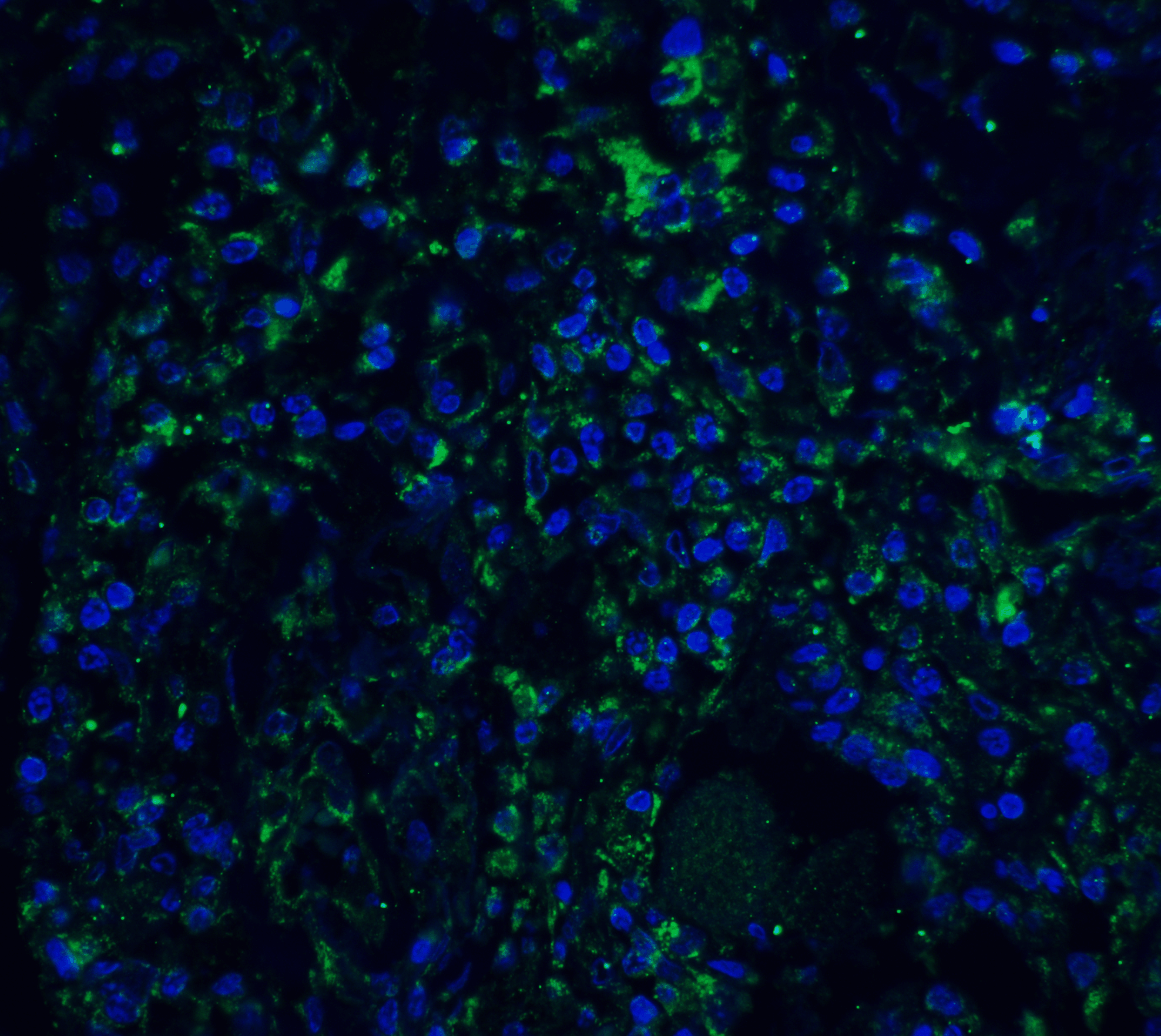 IHC-plus™ STAT1 Antibody