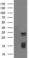 Monoclonal Mouse anti-Human TRIM38 Antibody (clone OTI1D6, IHC, WB)