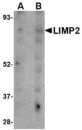 Polyclonal Rabbit anti-Human LIMPII / SCARB2 Antibody (IHC, WB)