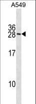 IHC-plus™ RNF182 Antibody (aa1-30)