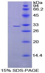 Rat PD-L2 / PDCD1LG2 / CD273 Protein (Recombinant His-T7)