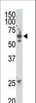 SENP2 Antibody (aa502-533)