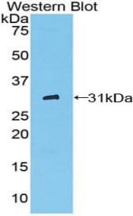CD32A Antibody (aa47-285)