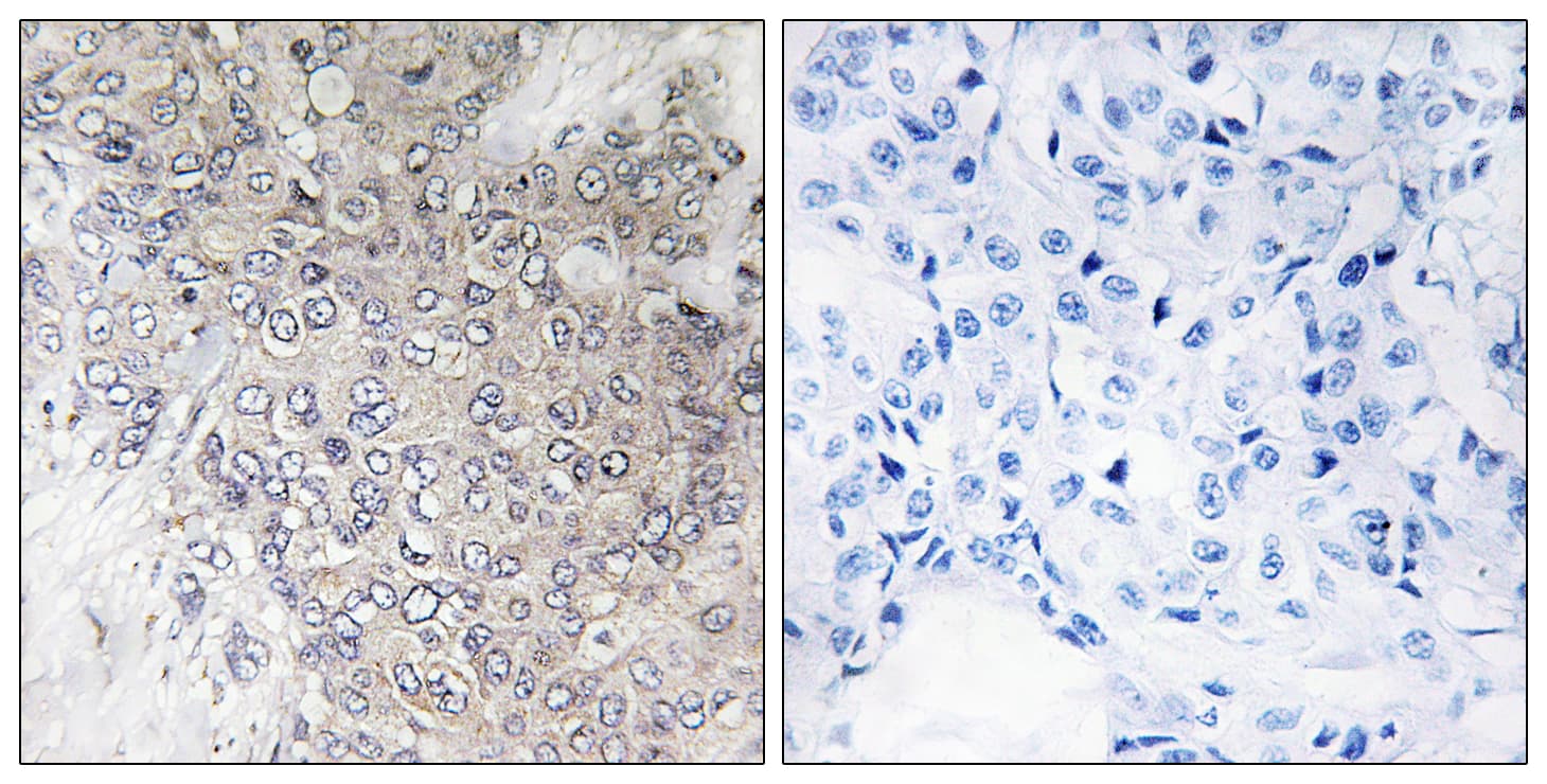Polyclonal Rabbit anti-Human RPS6KB1 / P70S6K / S6K Antibody (phospho-Thr421, IHC, WB)
