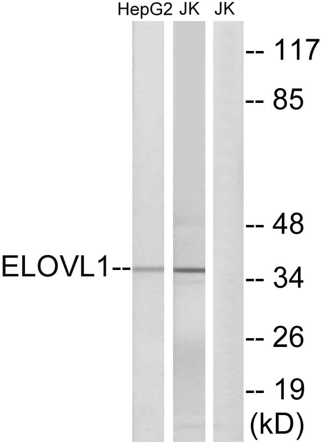 Polyclonal Rabbit anti-Human ELOVL1 Antibody (aa101-150, WB)