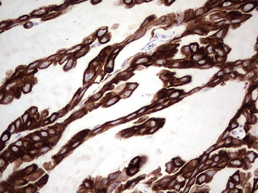 KRT19 / CK19 / Cytokeratin 19 Antibody (aa240-390, clone UMAB186, Carrier-free)
