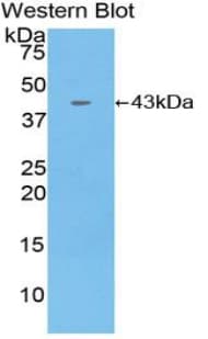 CCL4 / MIP-1 Beta Antibody (aa1-92)