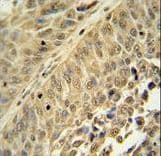 HNRNPC / HNRNP C Antibody (aa279-306)