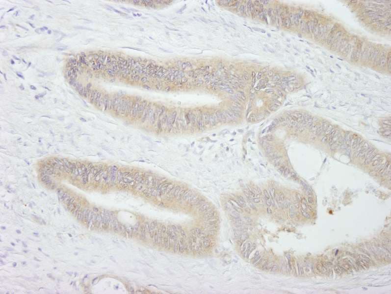 Polyclonal Rabbit anti-Human PTP-PEST / PTPN12 Antibody (aa760-780, IHC, IF)