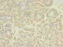 Polyclonal Rabbit anti-Human ACLY / ATP Citrate Lyase Antibody (IHC)