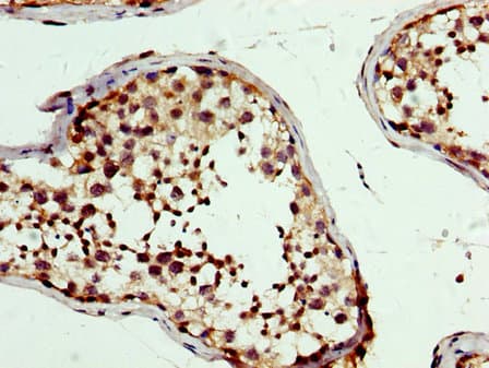 PBX1 Antibody