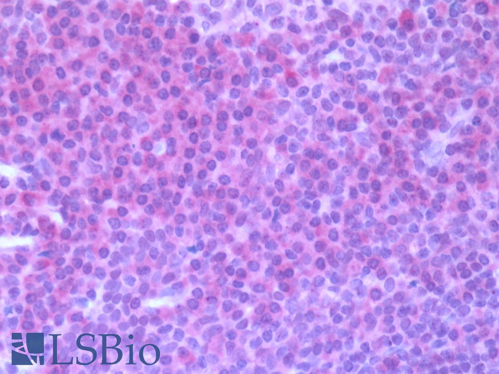 PathPlus™ Polyclonal Rabbit anti-Human CCR7 Antibody (N-Terminus, IHC)