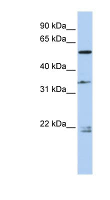 DPYSL2 / CRMP2 Antibody (aa432-481)