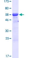 Human MTL5 / TESMIN Protein (Recombinant GST)