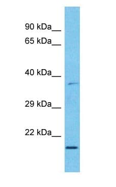 Polyclonal Rabbit anti-Human MXD3 / MAD3 Antibody (C-Terminus, WB)