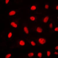 Polyclonal Rabbit anti-Human ELK1 Antibody (N-Terminus, IHC, IF, WB)