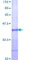 Human SORL1 Protein (Recombinant GST, N-terminus)