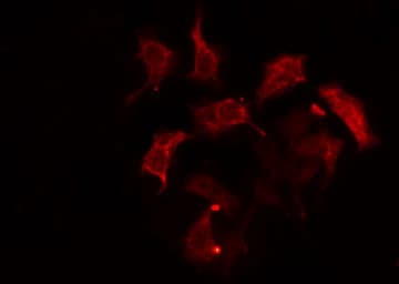 CA6 / Carbonic Anhydrase 6 Antibody