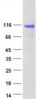 Human AGAP3 / CENTG3 / MRIP-1 Protein (Recombinant Myc-DDK (Flag))