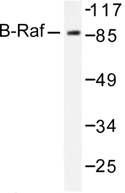 BRAF / B-Raf Antibody (Ala597)