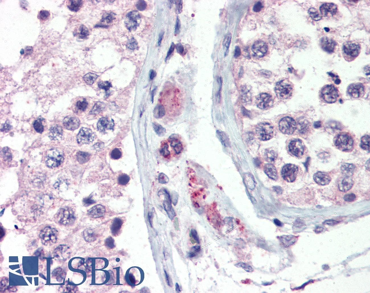 IHC-plus™ Polyclonal Rabbit anti-Human ADGRV1 / GPR98 Antibody (N-Terminus, IHC)