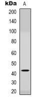 CCR6 Antibody (N-Terminus)