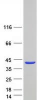Human SYCE2 Protein (Recombinant Myc-DDK (Flag))