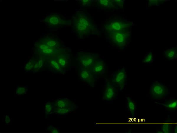 TCF7L2 / TCG4 Antibody (clone 3A4)