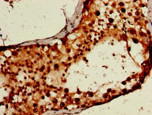 Polyclonal Rabbit anti-Human TIP48 / RUVBL2 Antibody (IHC, WB)