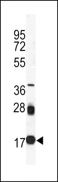 UBE2I / UBC9 Antibody (clone 67AT1273.95.90)