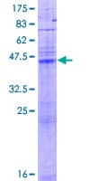 Human LASS1 Protein (Recombinant GST)