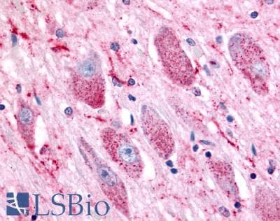 PathPlus™ GPR119 Antibody (Cytoplasmic Domain)