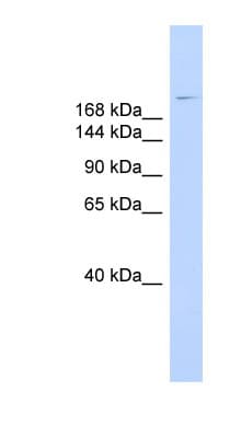 Dysferlin Antibody (aa215-264)