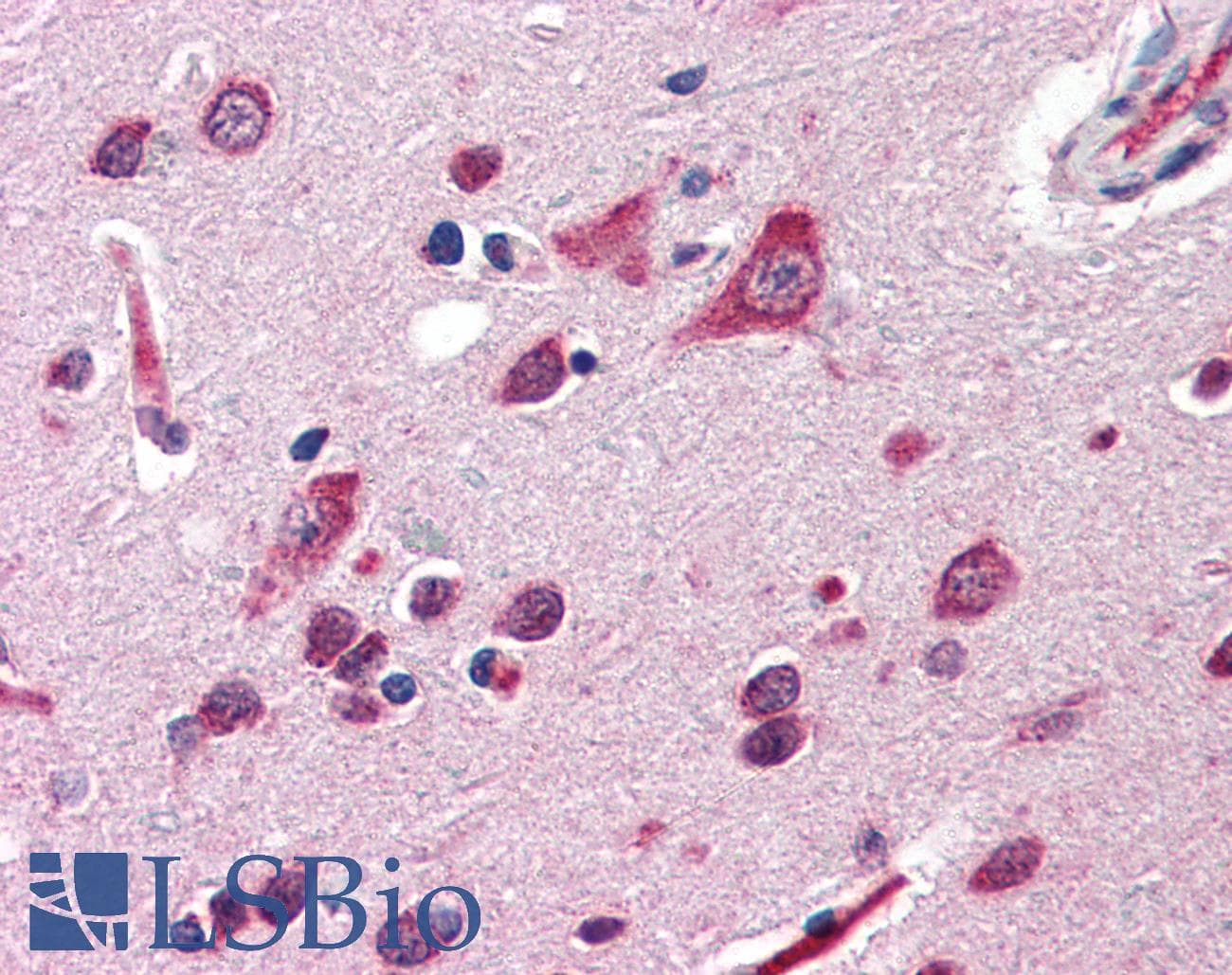 IHC-plus™ QSOX2 Antibody (Internal)