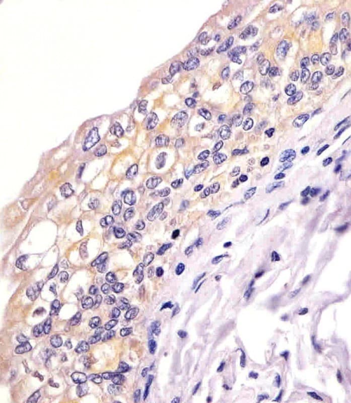 BID Antibody (clone 1519CT649.18.47)